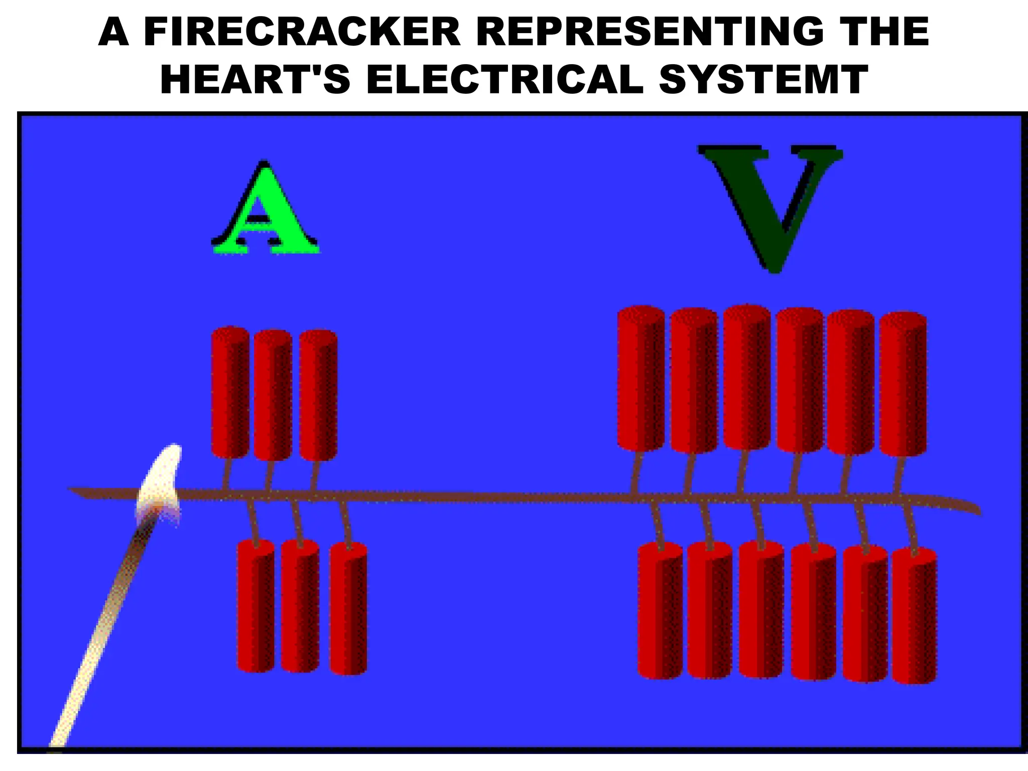 A FIRECRACKER REPRESENTING THE
HEART'S ELECTRICAL SYSTEMT
 
