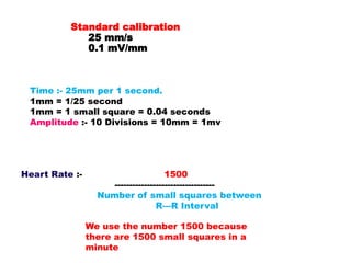 Heart Rate :- 1500
----------------------------------
Number of small squares between
R—R Interval
Time :- 25mm per 1 second.
1mm = 1/25 second
1mm = 1 small square = 0.04 seconds
Amplitude :- 10 Divisions = 10mm = 1mv
Standard calibration
25 mm/s
0.1 mV/mm
We use the number 1500 because
there are 1500 small squares in a
minute
 