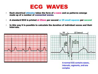 ECG WAVES
• Each electrical stimulus takes the form of a wave and so patterns emerge
made up of a number of connected waves.
• A standard ECG is printed at 25mm per second or 25 small squares per second
• In this way it is possible to calculate the duration of individual waves and their
intervals.
A normal ECG contains waves,
intervals, segments, and one
complex
 