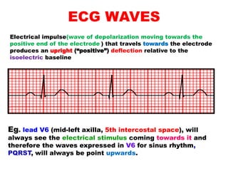 ECG WAVES
Electrical impulse(wave of depolarization moving towards the
positive end of the electrode ) that travels towards the electrode
produces an upright (“positive”) deflection relative to the
isoelectric baseline
Eg. lead V6 (mid-left axilla, 5th intercostal space), will
always see the electrical stimulus coming towards it and
therefore the waves expressed in V6 for sinus rhythm,
PQRST, will always be point upwards.
 