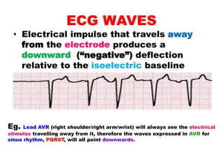 ECG WAVES
• Electrical impulse that travels away
from the electrode produces a
downward (“negative”) deflection
relative to the isoelectric baseline
Eg. Lead AVR (right shoulder/right arm/wrist) will always see the electrical
stimulus travelling away from it, therefore the waves expressed in AVR for
sinus rhythm, PQRST, will all point downwards.
 