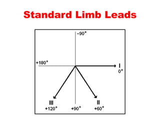 Standard Limb Leads
 