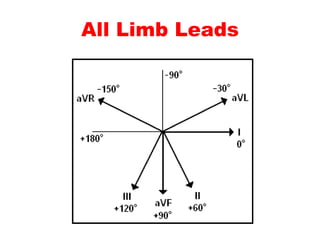 All Limb Leads
 