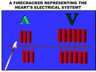 A FIRECRACKER REPRESENTING THE
HEART'S ELECTRICAL SYSTEMT
 