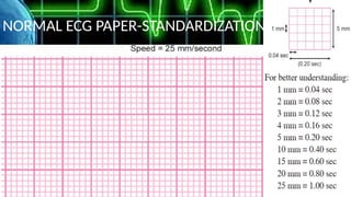 Comprehensive Guide to Electrocardiography: ECG Basics and ...