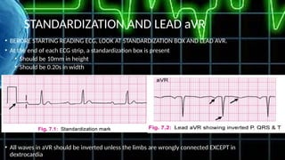 Comprehensive Guide to Electrocardiography: ECG Basics and ...