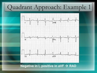 ECG BY Dr.MOHAMED RAMADAN | PPT