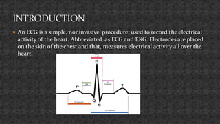 ECG Monitoring (Basic of ECG) | PPTX