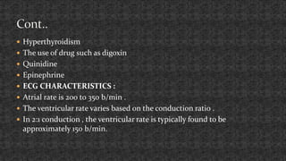 ECG Monitoring (Basic of ECG) | PPTX