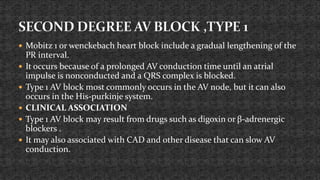 ECG Monitoring (Basic of ECG) | PPTX