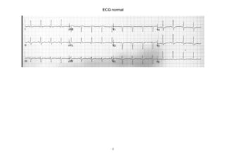 ECG normal




    2
 