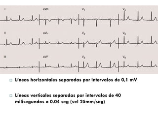 ¨ Líneas horizontales separadas por intervalos de 0,1 mV 
¨ Líneas verticales separadas por intervalos de 40 
milisegundos o 0.04 seg (vel 25mm/seg) 
 