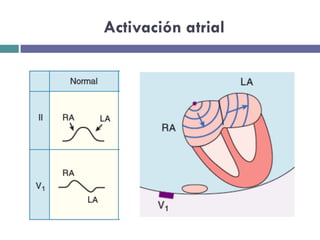 Activación atrial 
 