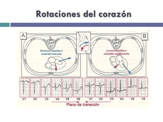 Rotaciones del corazón 
 