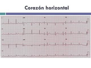 Corazón horizontal 
 