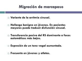 Migración de marcapaso 
¨ Variante de la arritmia sinusal. 
¨ Hallazgo benigno en jóvenes. En pacientes 
mayores puede traducir disfunción sinusal. 
¨ Transferencia pasiva del RS dominante a focos 
automáticos más bajos. 
¨ Expresión de un tono vagal aumentado. 
¨ Frecuente en jóvenes y atletas. 
 