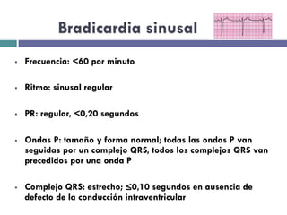 Bradicardia sinusal 
§ Frecuencia: <60 por minuto 
§ Ritmo: sinusal regular 
§ PR: regular, <0,20 segundos 
§ Ondas P: tamaño y forma normal; todas las ondas P van 
seguidas por un complejo QRS, todos los complejos QRS van 
precedidos por una onda P 
§ Complejo QRS: estrecho; ≤0,10 segundos en ausencia de 
defecto de la conducción intraventricular 
 