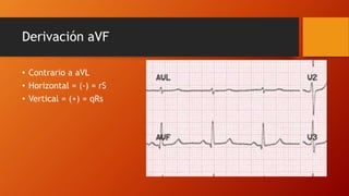 Derivación aVF
• Contrario a aVL
• Horizontal = (-) = rS
• Vertical = (+) = qRs
 