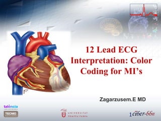 12 Lead ECG
Interpretation: Color
Coding for MI’s
Zagarzusem.E MD
1
 