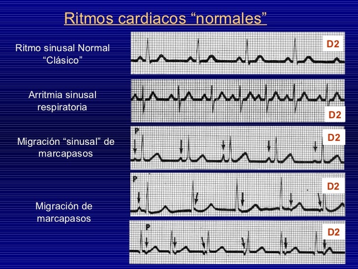 Ecg normal