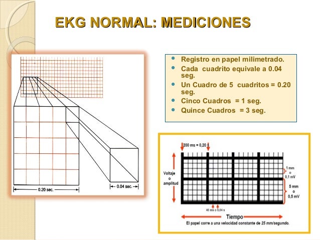 Electrocardiograma Normal