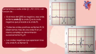Onda R Ecg Ecg normal el bueno para exponer ecg.pdf