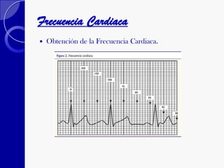 Frecuencia Cardiaca
 Obtención de la Frecuencia Cardiaca.
 