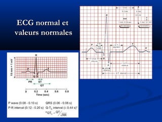 ECG normal etECG normal et
valeurs normalesvaleurs normales
 