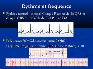 Rythme et fréquenceRythme et fréquence
 Rythme normal= sinusal: Chaque P est suivie de QRS etRythme normal= sinusal: Chaque P est suivie de QRS et
chaque QRS est précédé de P et P + en D2chaque QRS est précédé de P et P + en D2
 Fréquence: 300/Gd carreaux entre 2 QRSFréquence: 300/Gd carreaux entre 2 QRS
Si rythme irrégulier: nombre QRS sur 15cm (6sec) X 10Si rythme irrégulier: nombre QRS sur 15cm (6sec) X 10
 