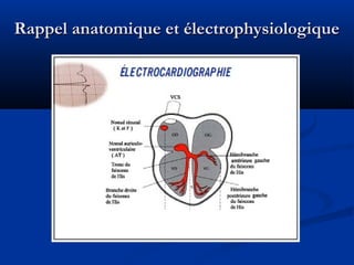 Rappel anatomique et électrophysiologiqueRappel anatomique et électrophysiologique
 