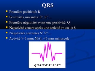 QRSQRS
 Première positivité: RPremière positivité: R
 Positivités suivantes: R’, R’’…Positivités suivantes: R’, R’’…
 Première négativité avant une positivité: QPremière négativité avant une positivité: Q
 Négativité venant après une activité (+ ou -): SNégativité venant après une activité (+ ou -): S
 Négativités suivantes S’, S’’…Négativités suivantes S’, S’’…
 Activité > 5 mm: MAJ, <5 mm minusculeActivité > 5 mm: MAJ, <5 mm minuscule
 