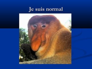 Je suis normalJe suis normal
 