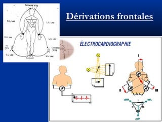 Dérivations frontales
 