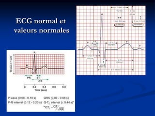 ECG normal et
valeurs normales
 