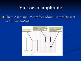 Vitesse et amplitude
 Unité Ashmann: 25mm/sec (donc 1mm=0.04sec)
et 1mm= 1mVolt
 