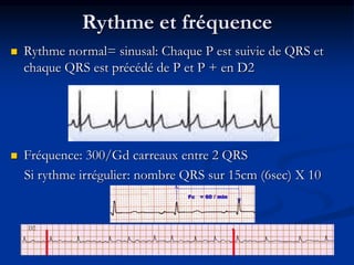 Rythme et fréquence
 Rythme normal= sinusal: Chaque P est suivie de QRS et
chaque QRS est précédé de P et P + en D2
 Fréquence: 300/Gd carreaux entre 2 QRS
Si rythme irrégulier: nombre QRS sur 15cm (6sec) X 10
 