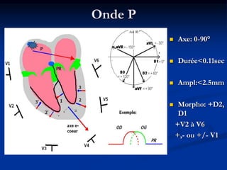 Onde P
 Axe: 0-90°
 Durée<0.11sec
 Ampl:<2.5mm
 Morpho: +D2,
D1
+V2 à V6
+,- ou +/- V1
 