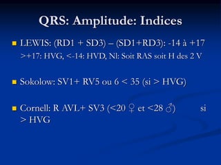 QRS: Amplitude: Indices
 LEWIS: (RD1 + SD3) – (SD1+RD3): -14 à +17
>+17: HVG, <-14: HVD, Nl: Soit RAS soit H des 2 V
 Sokolow: SV1+ RV5 ou 6 < 35 (si > HVG)
 Cornell: R AVL+ SV3 (<20 ♀ et <28 ♂) si
> HVG
 