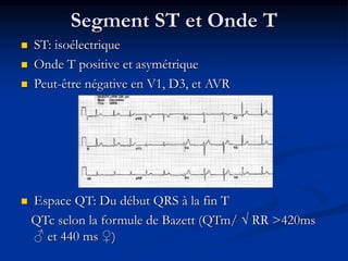 Segment ST et Onde T
 ST: isoélectrique
 Onde T positive et asymétrique
 Peut-être négative en V1, D3, et AVR
 Espace QT: Du début QRS à la fin T
QTc selon la formule de Bazett (QTm/ √ RR >420ms
♂ et 440 ms ♀)
 