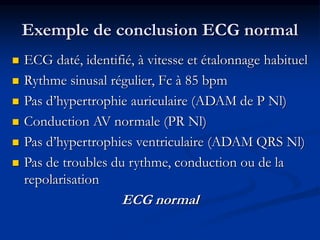 Exemple de conclusion ECG normal
 ECG daté, identifié, à vitesse et étalonnage habituel
 Rythme sinusal régulier, Fc à 85 bpm
 Pas d’hypertrophie auriculaire (ADAM de P Nl)
 Conduction AV normale (PR Nl)
 Pas d’hypertrophies ventriculaire (ADAM QRS Nl)
 Pas de troubles du rythme, conduction ou de la
repolarisation
ECG normal
 