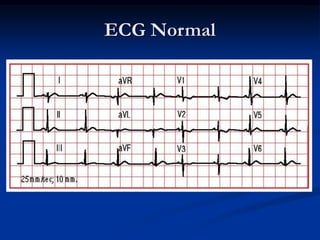 ECG Normal
 