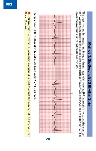 Ecg note | PDF