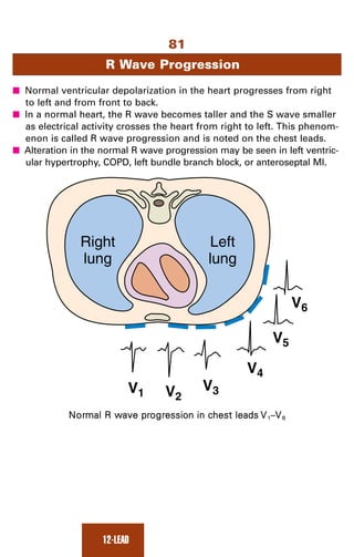 Ecg note | PDF