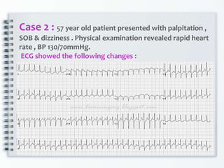 Case 2 : 57 year old patient presented with palpitation ,
SOB & dizziness . Physical examination revealed rapid heart
rate , BP 130/70mmHg.
ECG showed the following changes :
 
