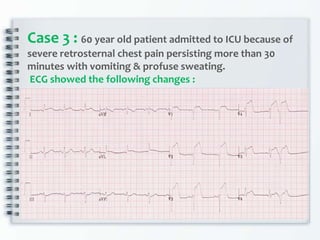 Case 3 : 60 year old patient admitted to ICU because of
severe retrosternal chest pain persisting more than 30
minutes with vomiting & profuse sweating.
ECG showed the following changes :
 