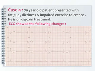 Case 4 : 70 year old patient presented with
fatigue , dizziness & impaired exercise tolerance .
He is on digoxin treatment.
ECG showed the following changes :
 