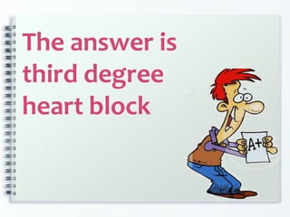 The answer is
third degree
heart block
 