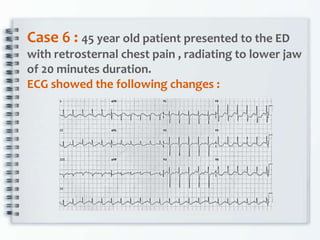 Case 6 : 45 year old patient presented to the ED
with retrosternal chest pain , radiating to lower jaw
of 20 minutes duration.
ECG showed the following changes :
 