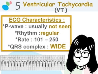 Ventricular Tachycardia
(VT )
ECG Characteristics :
*P-wave : usually not seen
*Rhythm :regular
*Rate : 101 – 250
*QRS complex : WIDE
5
 