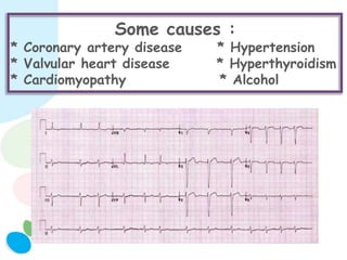 Some causes :
* Coronary artery disease * Hypertension
* Valvular heart disease * Hyperthyroidism
* Cardiomyopathy * Alcohol
 